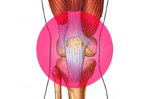 変形性膝関節症の症状と治療法
